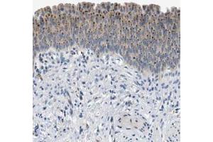 Immunohistochemical staining (Formalin-fixed paraffin-embedded sections) of human urinary bladder with EMR3 polyclonal antibody  shows dot like cytoplasmic positivity in urothelial cells at 1:50-1:200 dilution. (EMR3 Antikörper)