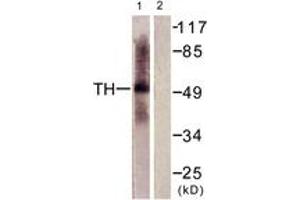 Western blot analysis of extracts from HepG2 cells, using Tryptophan Hydroxylase (Ab-58) Antibody. (Tryptophan Hydroxylase 1 Antikörper  (AA 26-75))