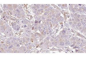 Immunohistochemistry (IHC) image for anti-Purinergic Receptor P2Y, G-Protein Coupled, 10 (P2RY10) (Internal Region) antibody (ABIN6263948)