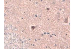 Detection of IL18 in Rat Spinal cord Tissue using Polyclonal Antibody to Interleukin 18 (IL18) (IL-18 Antikörper  (AA 37-194))