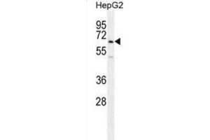 Western Blotting (WB) image for anti-Ubiquitin Family Domain Containing 1 (UBFD1) antibody (ABIN2996005) (UBFD1 Antikörper)