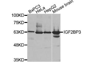 Western Blotting (WB) image for anti-Insulin-Like Growth Factor 2 mRNA Binding Protein 3 (IGF2BP3) antibody (ABIN1873168) (IGF2BP3 Antikörper)