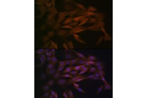 Immunofluorescence analysis of NIH-3T3 cells using MEK3 Rabbit mAb (ABIN1682965, ABIN3017630, ABIN3017631 and ABIN7101512) at dilution of 1:100 (40x lens). (MAP2K3 Antikörper)