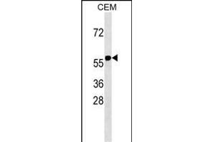 Western Blotting (WB) image for anti-Ring Finger Protein 31 (RNF31) (AA 955-983), (C-Term) antibody (ABIN1537664)