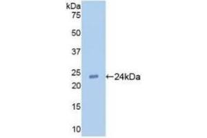 Detection of Recombinant TLR2, Human using Monoclonal Antibody to Toll Like Receptor 2 (TLR2) (TLR2 Antikörper  (AA 47-245))