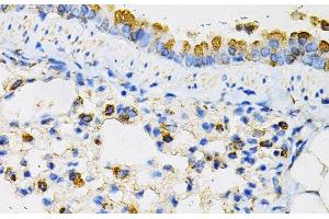Immunohistochemistry of paraffin-embedded Mouse lung using NPC2 Polyclonal Antibody at dilution of 1:100 (40x lens). (NPC2 Antikörper)