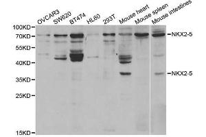 Western Blotting (WB) image for anti-NK2 Homeobox 5 (NKX2-5) antibody (ABIN1876852)