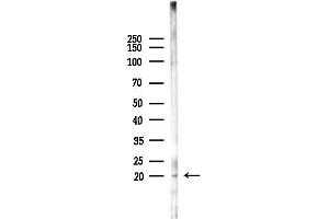 anti-Ring Finger Protein 5, E3 Ubiquitin Protein Ligase (RNF5) (C-Term) antibody