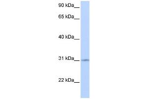 WB Suggested Anti-ZNF146 Antibody Titration:  0. (ZNF146 Antikörper  (Middle Region))