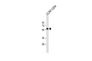 Western Blot at 1:1000 dilution + CCRF-CEM whole cell lysate Lysates/proteins at 20 ug per lane. (SLC22A6 Antikörper  (C-Term))