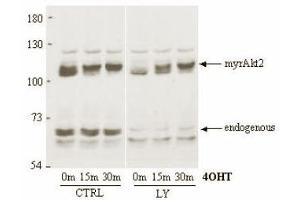 Immunoblotting. (AKT2 Antikörper)