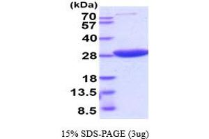 HPRT1 Protein (AA 1-218) (His tag)