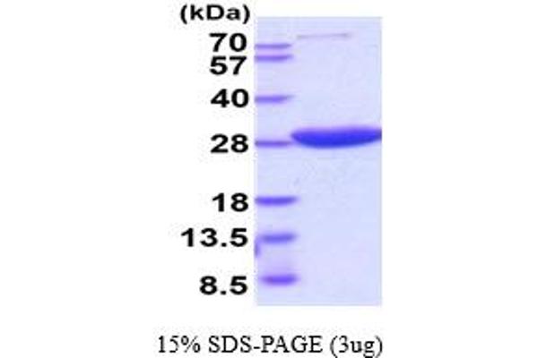 HPRT1 Protein (AA 1-218) (His tag)