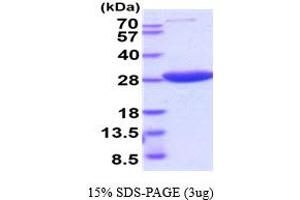 SDS-PAGE (SDS) image for Hypoxanthine phosphoribosyltransferase 1 (HPRT1) (AA 1-218) (Active) protein (His tag) (ABIN6387916)