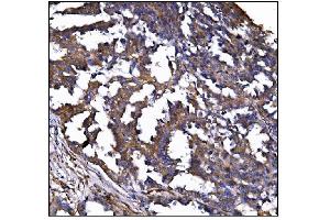 IHC analysis of POGLUT1 using anti-POGLUT1 antibody (ABIN7602910). (POGLUT1 Antikörper  (C-Term))