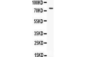 Anti-hCG receptor antibody, Western blotting All lanes: Anti hCG receptor  at 0. (LHCGR Antikörper  (N-Term))