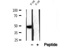 Western blot analysis of extracts of HT-1080 cells, using SMCR7/MID49 antibody. (SMCR7 Antikörper)