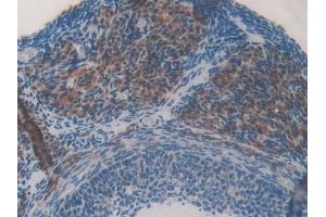 Immunohistochemistry (IHC) image for anti-serpin Peptidase Inhibitor, Clade A (Alpha-1 Antiproteinase, Antitrypsin), Member 6 (SERPINA6) (AA 268-391) antibody (ABIN7438403)