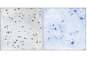Immunohistochemistry analysis of paraffin-embedded human brain tissue using DIL-2 antibody. (TPX2 Antikörper  (Internal Region))