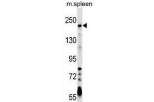 Western Blotting (WB) image for anti-Neogenin 1 (NEO1) antibody (ABIN2999720) (NEO1 Antikörper)