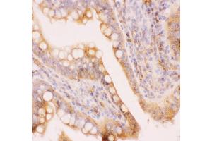 Anti-MRP4 Picoband antibody,  IHC(P): Rat Intestine Tissue (ABCC4 Antikörper  (AA 1-370))