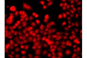 Immunofluorescence analysis of A549 cells using THAP1 antibody.