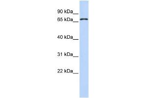 WB Suggested Anti-ZNF778 Antibody Titration:  0. (ZNF778 Antikörper  (N-Term))