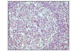 Immunohistochemical analysis of paraffin-embedded human normal lymph node, showing cytoplasmic localization using CD19 antibody with DAB staining. (CD19 Antikörper)