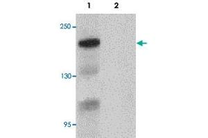 Western blot analysis of Bcl9L in HeLa cell lysate with BCL9L polyclonal antibody  at 1 ug/mL. (BCL9L Antikörper  (N-Term))