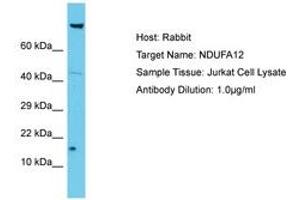 Image no. 1 for anti-NADH Dehydrogenase (Ubiquinone) 1 alpha Subcomplex, 12 (NDUFA12) (AA 6-55) antibody (ABIN6750643) (NDUFA12 Antikörper  (AA 6-55))