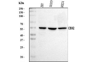 Western blot analysis of CBX2 using anti-CBX2 antibody (ABIN7599466).