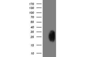 Western Blotting (WB) image for anti-phosphoglycerate Mutase 2 (Muscle) (PGAM2) antibody (ABIN1500173)