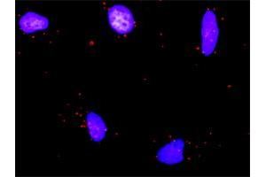 Proximity Ligation Assay (PLA) image for anti-Runt-Related Transcription Factor 1, Translocated To, 1 (Cyclin D-Related) (RUNX1T1) (AA 1-577) antibody (ABIN514061)