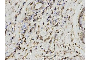 Immunohistochemistry (IHC) image for anti-Proteasome (Prosome, Macropain) Activator Subunit 1 (PA28 Alpha) (PSME1) antibody (ABIN1876546) (PSME1 Antikörper)