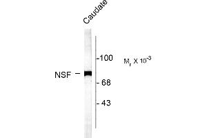 Western blots of rat caudate lysate showing specific labeling of the ~75k NSF protein. (NSF Antikörper  (C-Term))