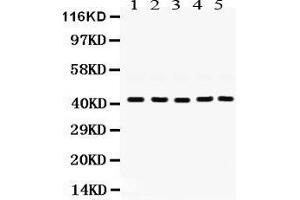 Western Blotting (WB) image for anti-Guanine Nucleotide Binding Protein (G Protein), Q Polypeptide (GNAQ) (AA 102-138), (N-Term) antibody (ABIN3043833) (GNAQ Antikörper  (N-Term))