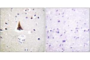 Immunohistochemistry (IHC) image for anti-Vav 2 Guanine Nucleotide Exchange Factor (VAV2) (AA 108-157) antibody (ABIN2888936) (VAV2 Antikörper  (AA 108-157))