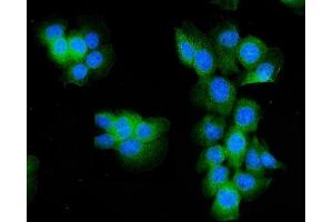 IF analysis of Aldolase/ALDOA using anti- Aldolase/ALDOA antibody (ABIN7601907). (ALDOA Antikörper  (AA 50-364))
