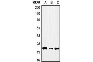Western blot analysis of IFN alpha 1 expression in HEK293T (A), NIH3T3 (B), H9C2 (C) whole cell lysates.