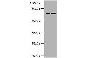 Western blot All lanes: AGUSB antibody at 2 μg/mL Lane 1: HL60 whole cell lysate Lane 2: HepG2 whole cell lysate Secondary Goat polyclonal to rabbit IgG at 1/10000 dilution Predicted band size: 75, 70, 59 kDa Observed band size: 75 kDa (Glucuronidase beta Antikörper  (AA 382-651))