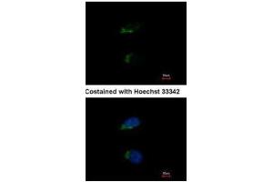 ICC/IF Image Immunofluorescence analysis of methanol-fixed HeLa, using JIK, antibody at 1:500 dilution. (TAO Kinase 3 Antikörper)