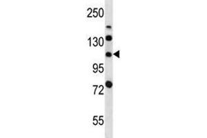 LRIG2 antibody western blot analysis in mouse bladder tissue lysate. (LRIG2 Antikörper  (AA 817-845))