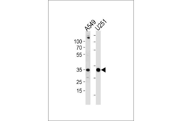 ASB9 Antikörper  (N-Term)