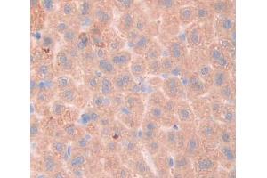 IHC-P analysis of liver tissue, with DAB staining. (Fibrosin Antikörper  (AA 11-247))