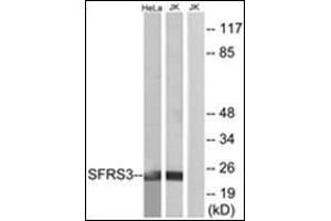 Western blot analysis of extracts from HeLa/Jurkat cells, using SFRS3 Antibody. (SRSF3 Antikörper  (C-Term))