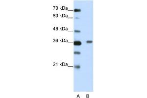 WB Suggested Anti-BTBD6 Antibody Titration:  2. (BTBD6 Antikörper  (N-Term))