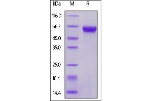 Biotinylated Human / Cynomolgus / Rhesus macaque ROR1, Avitag on  under reducing (R) condition.
