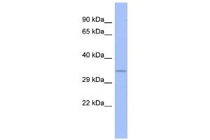 WB Suggested Anti-FUSIP1 Antibody Titration:  0. (SRSF10 Antikörper  (N-Term))