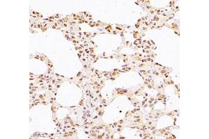 Immunohistochemistry of paraffin embedded rat lung using WDR13 (ABIN7076212) at dilution of 1: 2500 (400x lens) (WDR13 Antikörper)