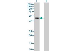 Western Blot analysis of AIPL1 expression in transfected 293T cell line by AIPL1 monoclonal antibody (M04), clone 1E1. (AIPL1 Antikörper  (AA 1-384))